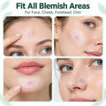 GTT Invisible Acne Patches — Hydrocolloid, Wear Under Makeup